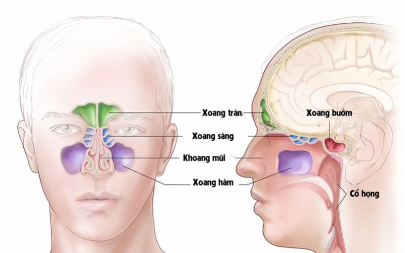 Viêm xoang sàng là một trong những tình trạng viêm xoang thường gặp