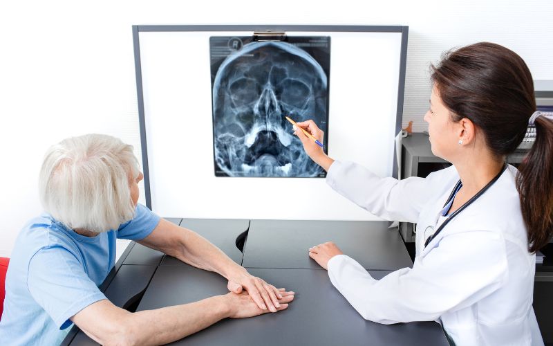 Một số trường hợp bác sĩ chỉ định chụp cắt lớp vi tính (CT Scan) để xác định tình trạng viêm xoang